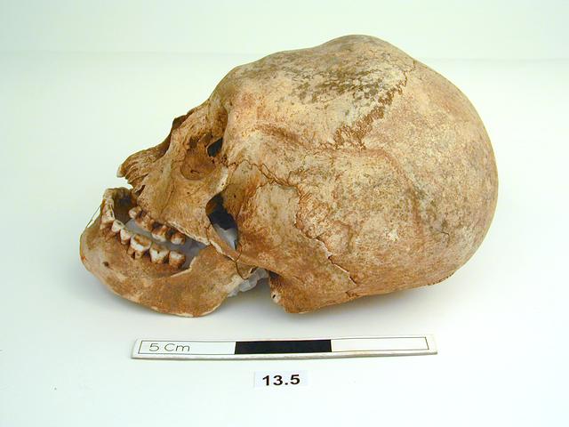modified skull