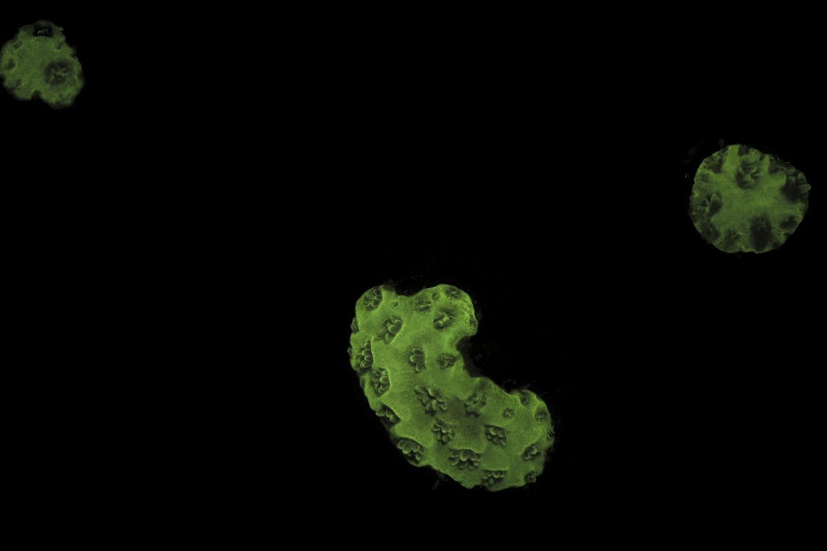 Fluorescent green baby corals on black background